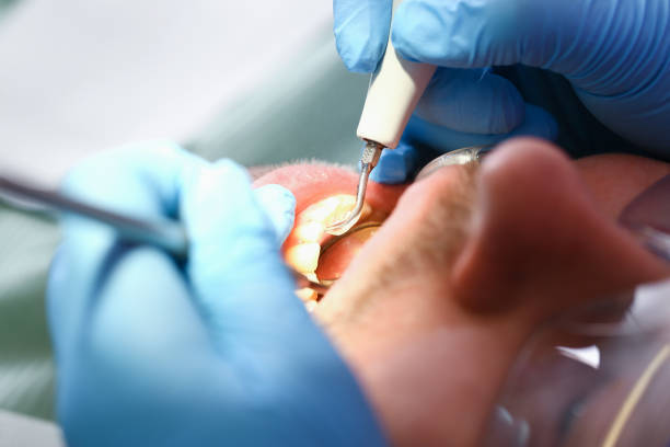 Best Urgent Dental Care for Toothaches in Kdeer, IL