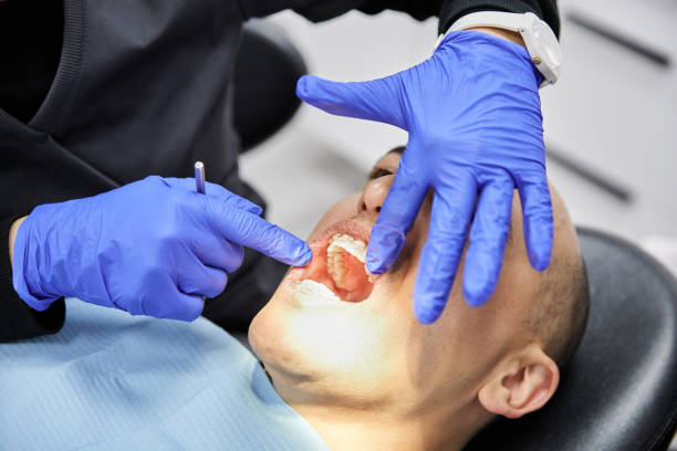 Best Broken or Chipped Tooth Repair in Kdeer, IL